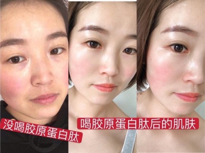长期喝胶原蛋白肽有啥好处？钰盈堂胶原蛋白肽深圳总代图2